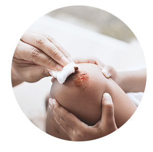 Cuts & Lacerations Image